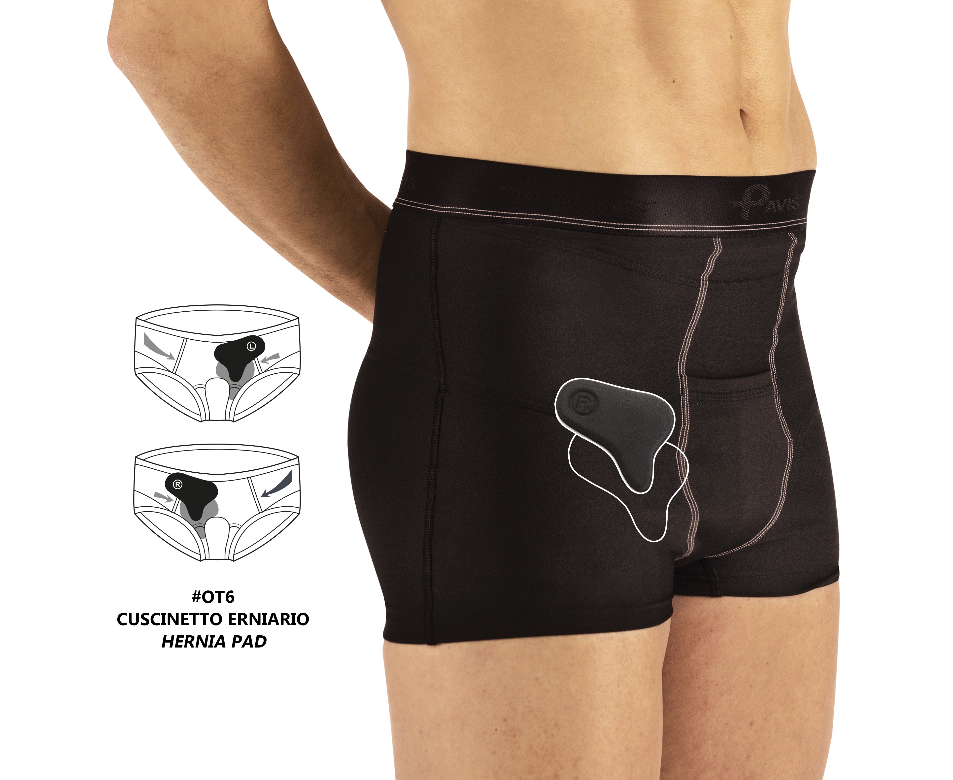 Ernia boxer